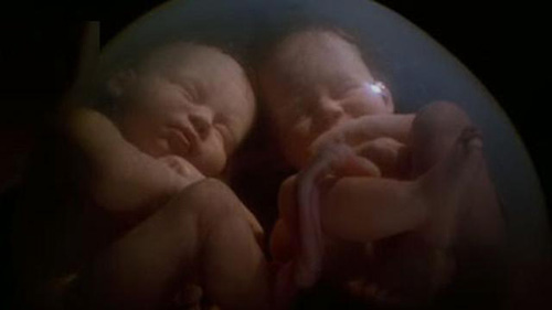 Gemelos ya bien desarrollados en la matriz de su madre, fotografía que ilustra el tema Gegmelos en la matriz de su madre entablan un diálogo.