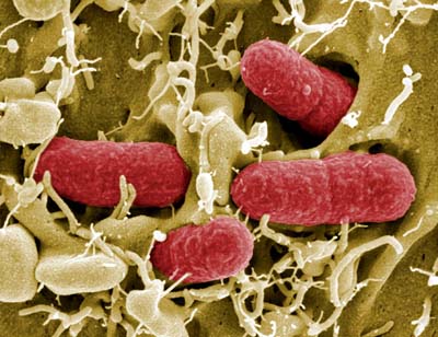 Una fotografía tomada con un microscopio electrono capta la bacteria EHEC (enterohaemorrhagic Escherichia coli). www.telegraph.co 